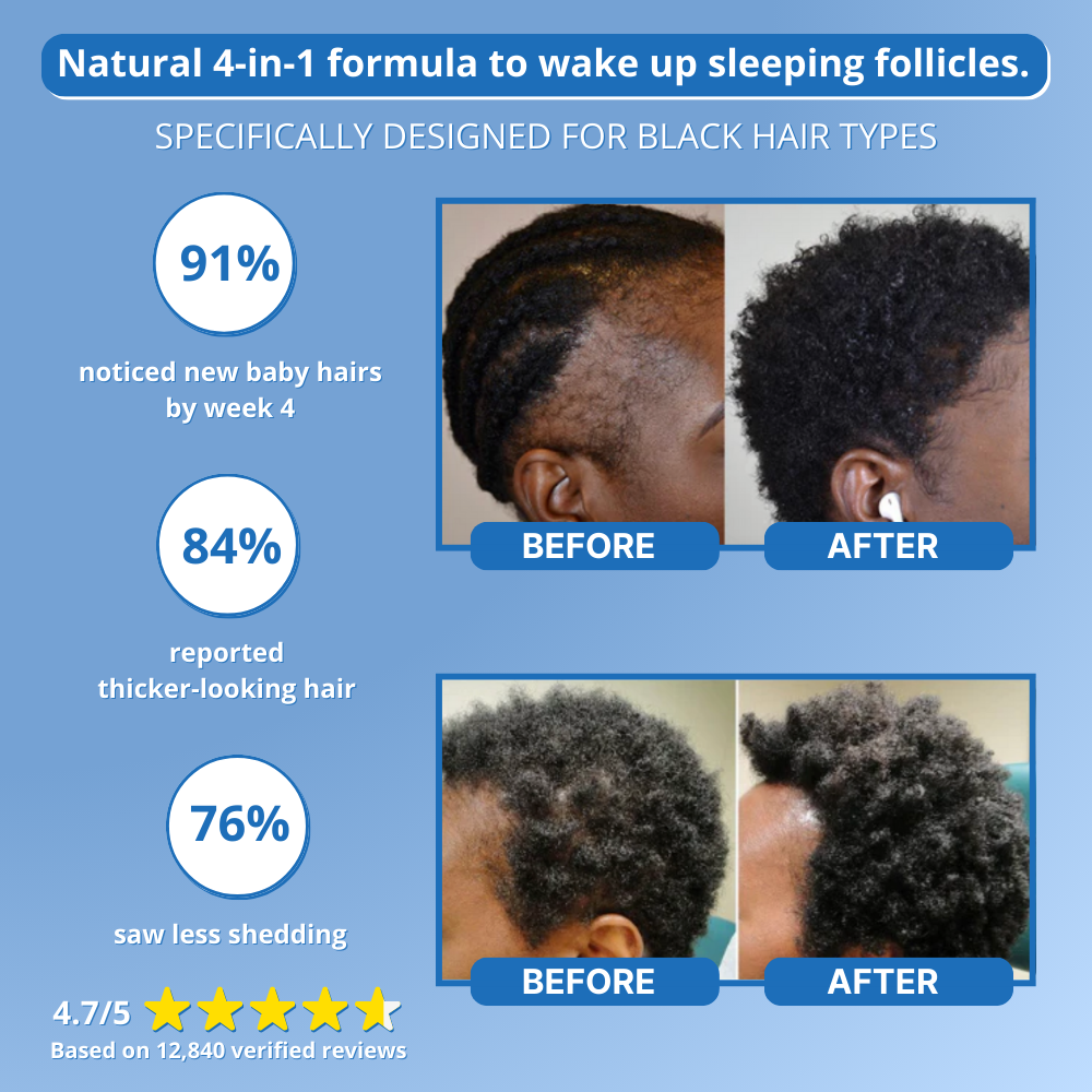 4-in-1 Hair Growth Roll-On Serum