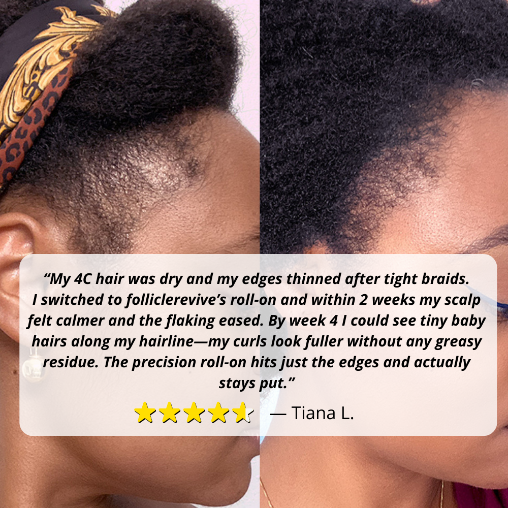 4-in-1 Hair Growth Roll-On Serum