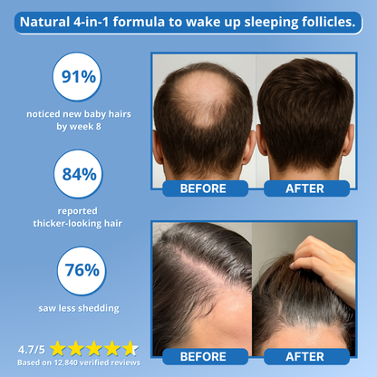 Follicle Awakening Hair Growth Roll-On Serum