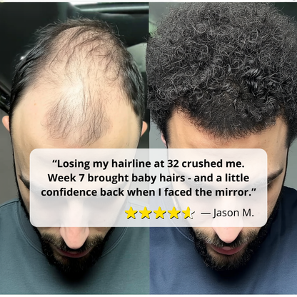 Follicle Awakening Hair Growth Roll-On Serum
